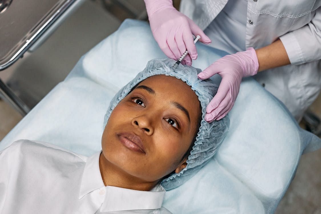 Before and after botox for migraines (Image via Pexels/Cottonbro Studio)